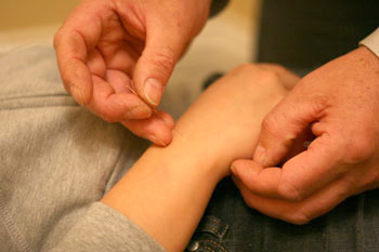 Nicholas performing acupuncture on a patient